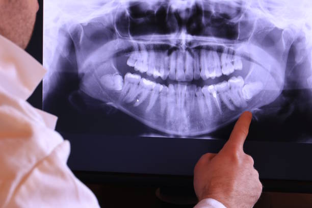 Best Emergency Dentist for Knocked-Out Tooth in Choteau, MT