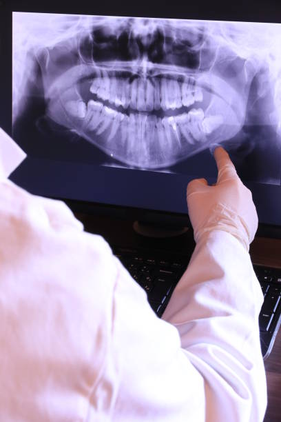 Best Broken or Cracked Tooth Emergency Dentist in Choteau, MT
